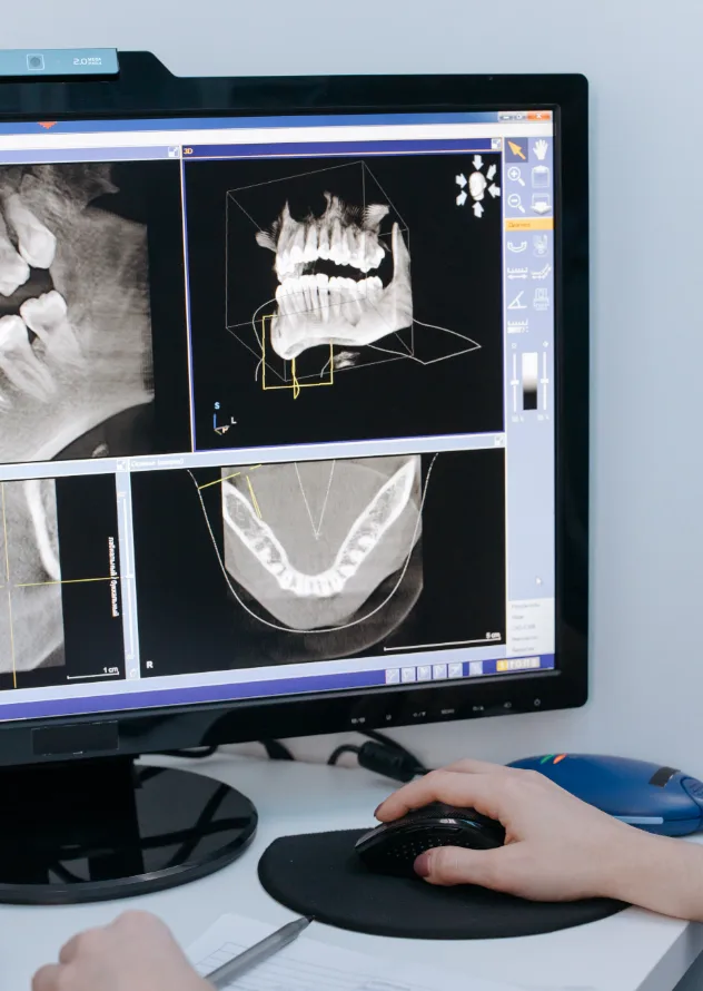 Oral Cancer Screening service Scarsdale