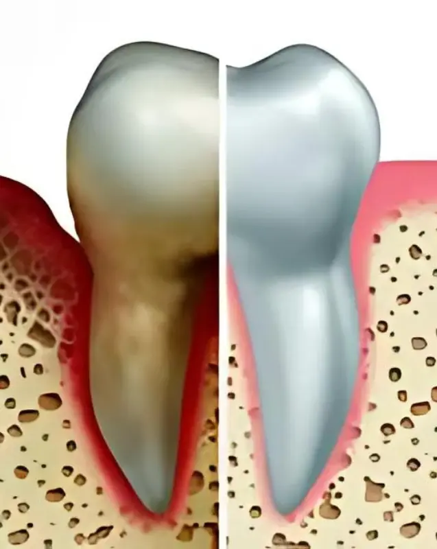 Periodontal Care Services in Scarsdale Periodontal Care Services in Scarsdale