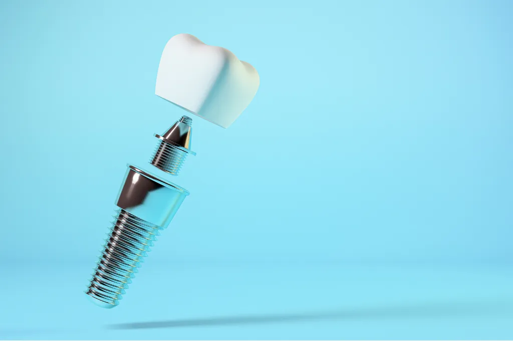What is Bone Graft Treatment