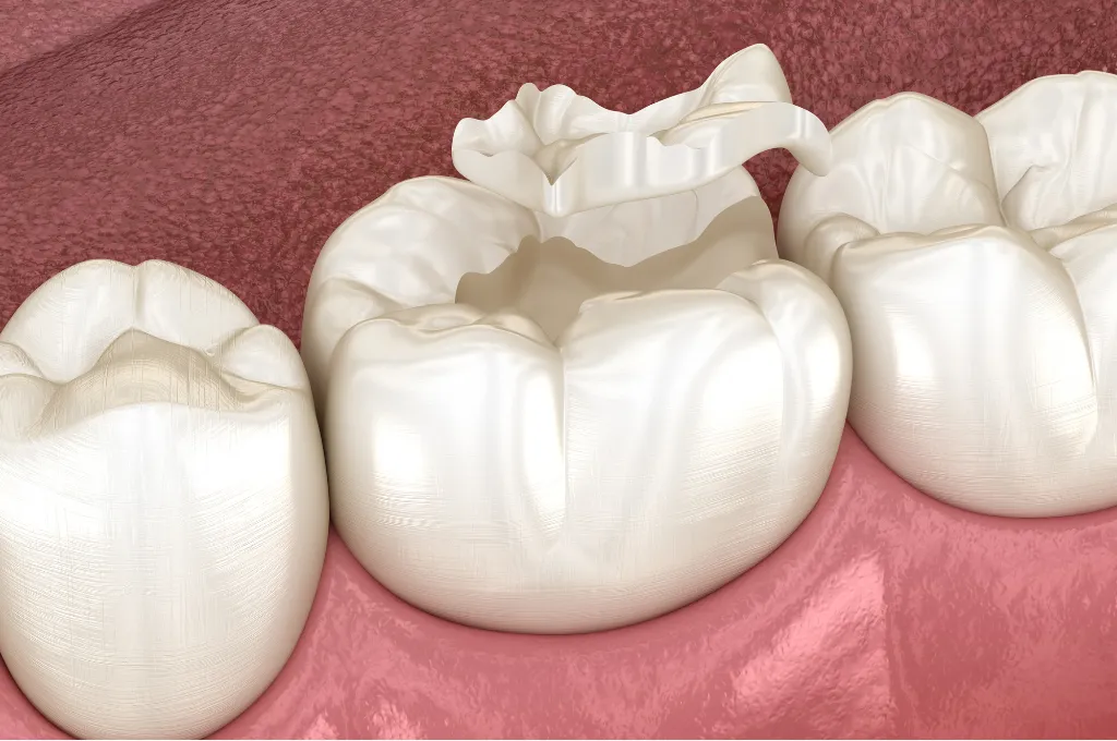 Why Choose Us for Dental Sealants in Scarsdale?