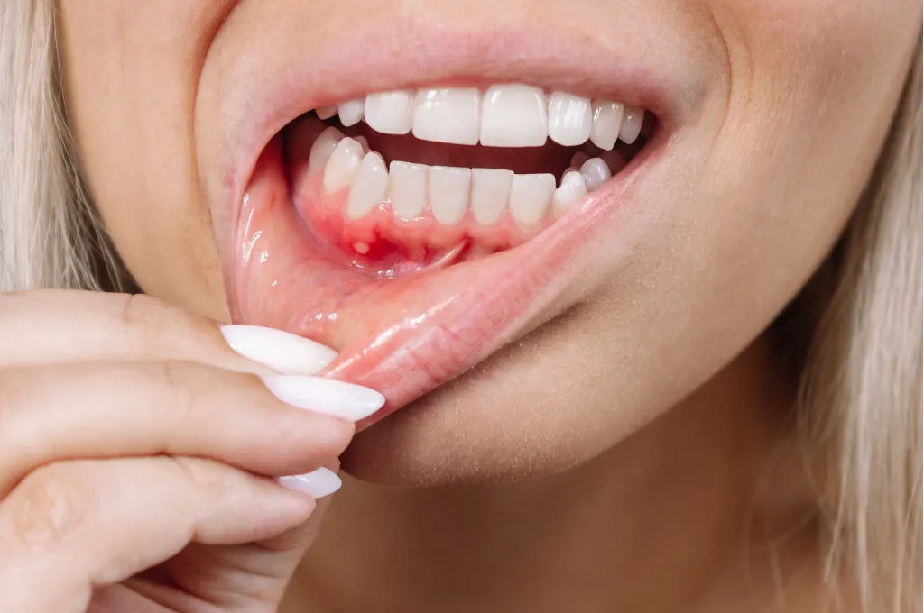 Why Choose Us for Gum Disese Treatment