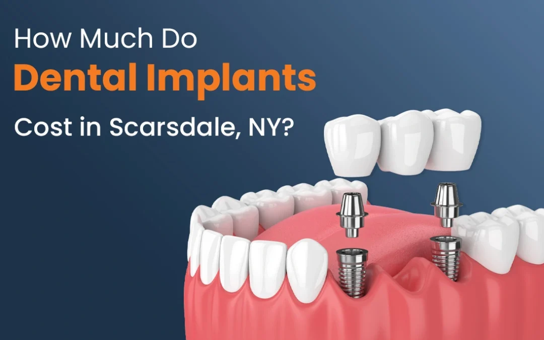 How Much Do Dental Implants Cost in Scarsdale, NY?