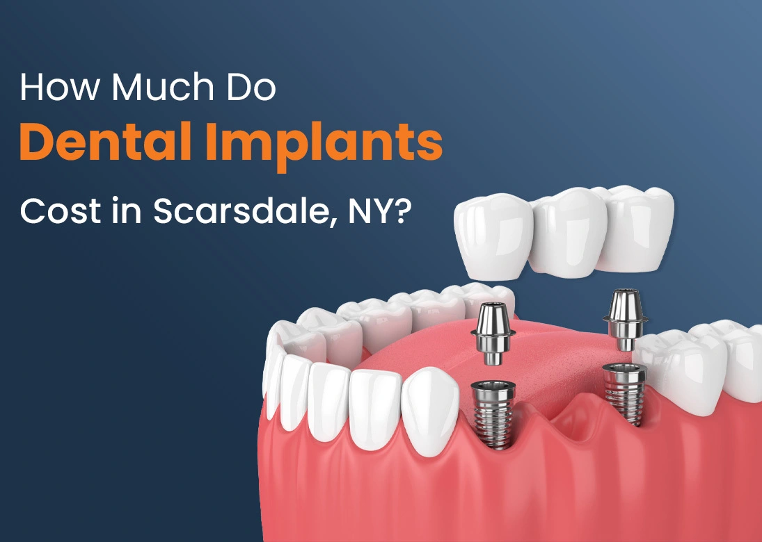 Dental implant cost