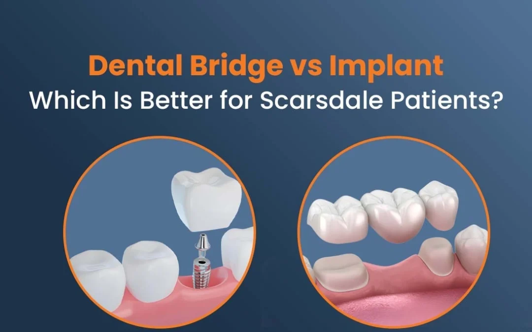 Dental Implants vs. Bridges: Which Is Better for Scarsdale Patients?