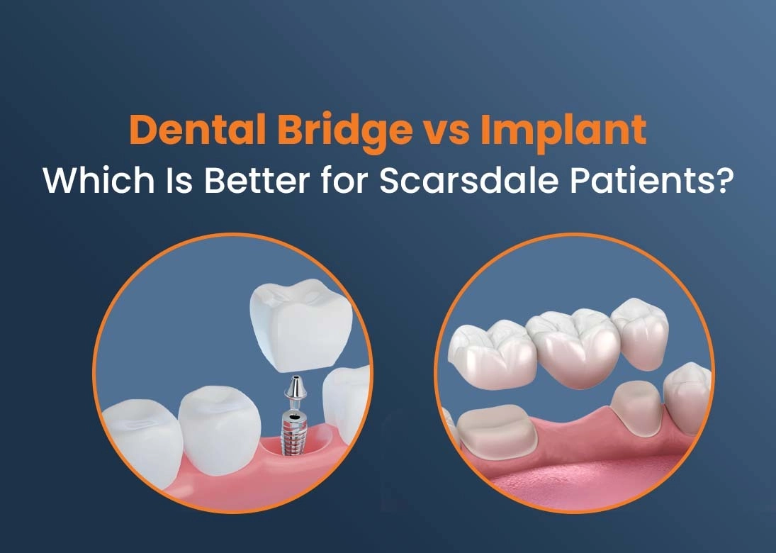 dental bridge vs implant at Smile Scarsdale Fmaily dental