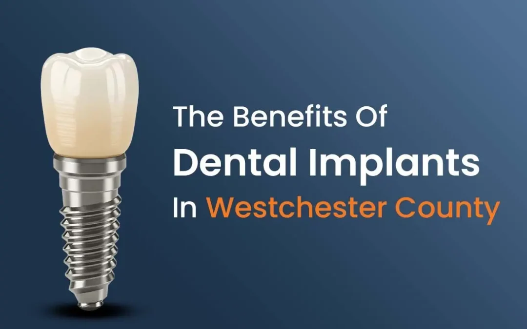 The Benefits Of Dental Implants in Westchester County