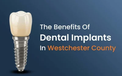 The Benefits Of Dental Implants in Westchester County