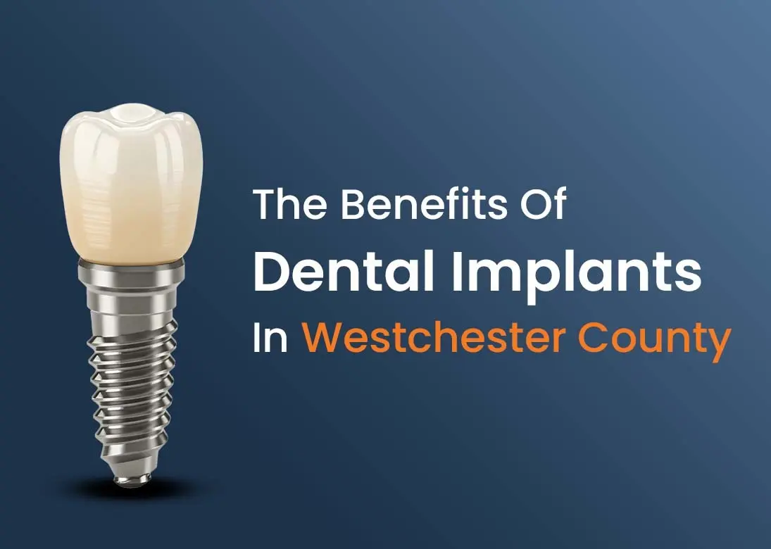 the benefits of dental implants in Westchester county