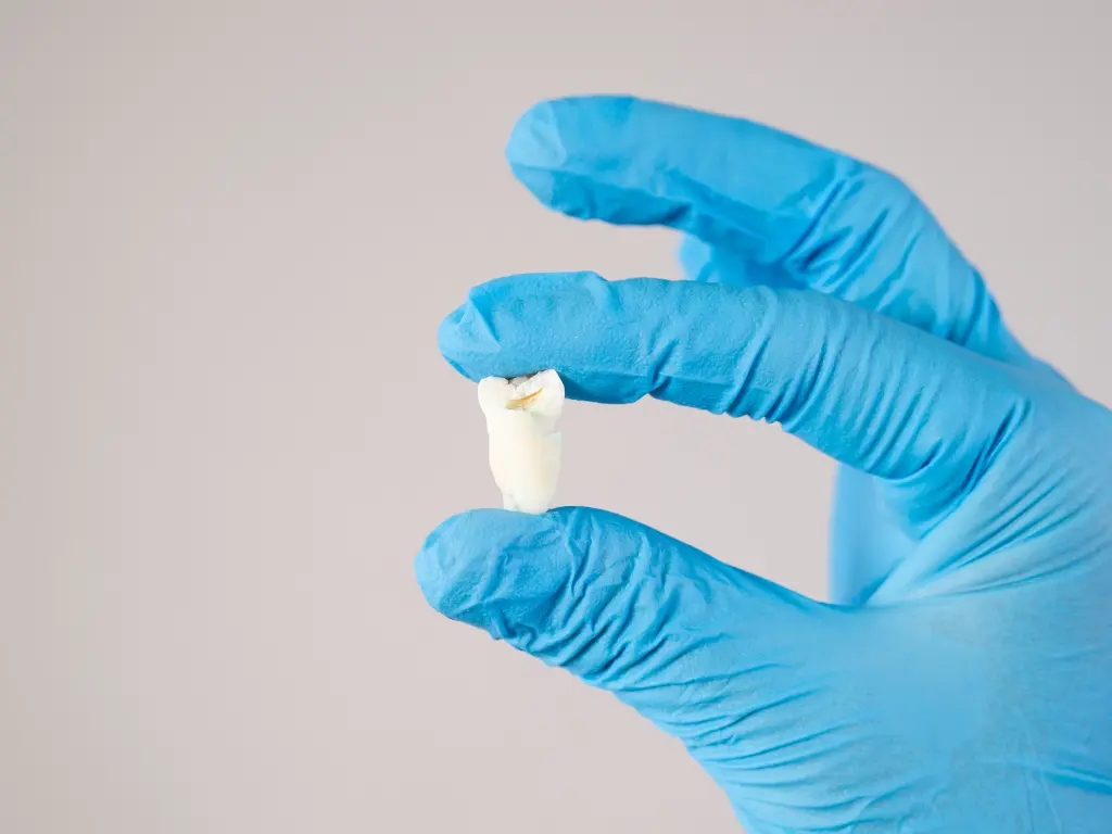 What Is Teeth Extraction