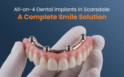All-on-4 Dental Implants in Scarsdale: A Complete Smile Solution