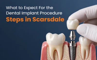 What to Expect For the Dental Implant Procedure Steps in Scarsdale
