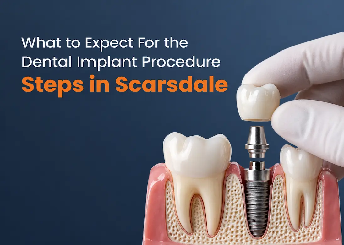 What to Expect For the Dental Implant Procedure Steps in Scarsdale