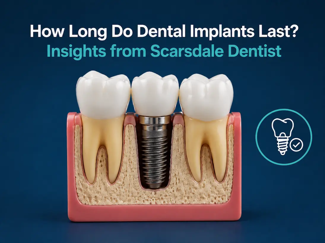 How Long Do Dental Implants Last Insights from Scarsdale Dentist