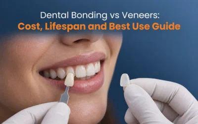 Dental Bonding vs Veneers: Cost, Lifespan and Best Use Guide