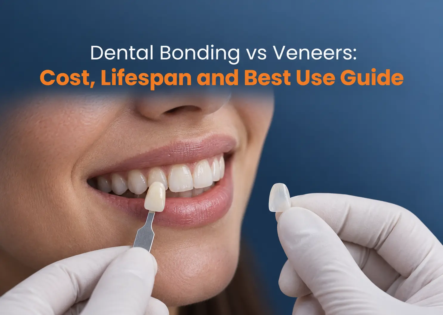 Dental Bonding vs Veneers: Cost, Lifespan and Best Use Guide